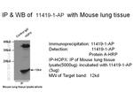 HOPX Antibody in Immunoprecipitation (IP)