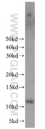 HOPX Antibody in Western Blot (WB)