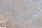 RAB9A Antibody in Immunohistochemistry (Paraffin) (IHC (P))