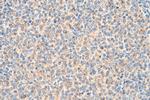 RAB9A Antibody in Immunohistochemistry (Paraffin) (IHC (P))