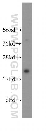 RAB9A Antibody in Western Blot (WB)