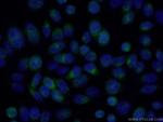 RAB9A Antibody in Immunocytochemistry (ICC/IF)