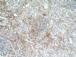 RAB9A Antibody in Immunohistochemistry (Paraffin) (IHC (P))