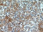 RAB9A Antibody in Immunohistochemistry (Paraffin) (IHC (P))