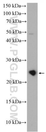 RAB9A Antibody in Western Blot (WB)