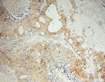 MARCKSL1 Antibody in Immunohistochemistry (Paraffin) (IHC (P))