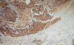 MARCKSL1 Antibody in Immunohistochemistry (Paraffin) (IHC (P))