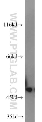 MARCKSL1 Antibody in Western Blot (WB)