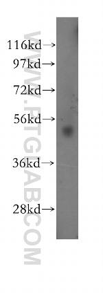 RARG Antibody in Western Blot (WB)