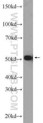 HNRNPK Antibody in Western Blot (WB)