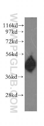 Kallistatin Antibody in Western Blot (WB)