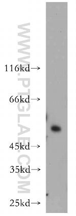 SESN3 Antibody in Western Blot (WB)