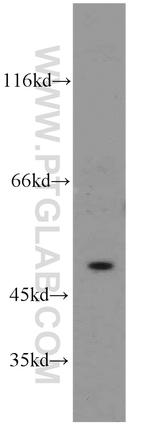 SESN3 Antibody in Western Blot (WB)