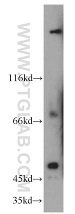 SESN3 Antibody in Western Blot (WB)