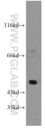 SESN3 Antibody in Western Blot (WB)