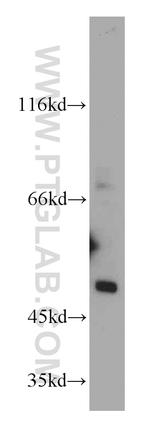 SESN3 Antibody in Western Blot (WB)