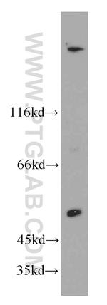 SESN3 Antibody in Western Blot (WB)