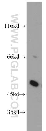 SESN3 Antibody in Western Blot (WB)