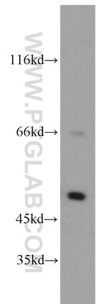 SESN3 Antibody in Western Blot (WB)