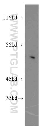 SESN3 Antibody in Western Blot (WB)