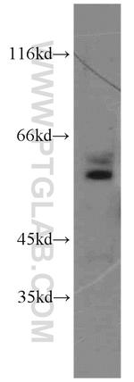 SESN3 Antibody in Western Blot (WB)