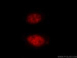 HAT1 Antibody in Immunocytochemistry (ICC/IF)