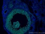 HAT1 Antibody in Immunohistochemistry (PFA fixed) (IHC (PFA))