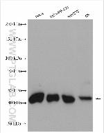 HAT1 Antibody in Western Blot (WB)