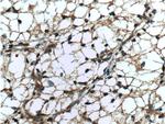 GRK6 Antibody in Immunohistochemistry (Paraffin) (IHC (P))