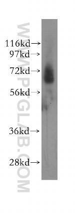 GRK6 Antibody in Western Blot (WB)