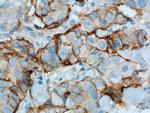 VCAM-1 Antibody in Immunohistochemistry (Paraffin) (IHC (P))