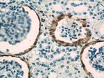 VCAM-1 Antibody in Immunohistochemistry (Paraffin) (IHC (P))