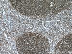 VCAM-1 Antibody in Immunohistochemistry (Paraffin) (IHC (P))