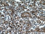 VCAM-1 Antibody in Immunohistochemistry (Paraffin) (IHC (P))