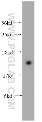 RAB24 Antibody in Western Blot (WB)