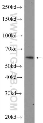 GTF3C5 Antibody in Western Blot (WB)