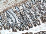 NQO1 Antibody in Immunohistochemistry (Paraffin) (IHC (P))