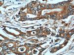 NQO1 Antibody in Immunohistochemistry (Paraffin) (IHC (P))