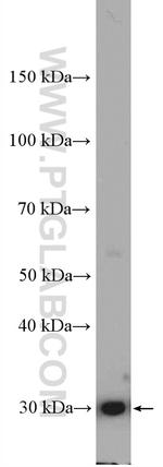 NQO1 Antibody in Western Blot (WB)