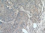 Kindlin 2 Antibody in Immunohistochemistry (Paraffin) (IHC (P))