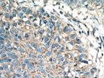 Kindlin 2 Antibody in Immunohistochemistry (Paraffin) (IHC (P))