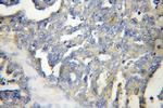 Kindlin 2 Antibody in Immunohistochemistry (Paraffin) (IHC (P))