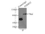 Kindlin 2 Antibody in Immunoprecipitation (IP)