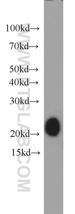 MZB1 Antibody in Western Blot (WB)