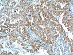 S100A16 Antibody in Immunohistochemistry (Paraffin) (IHC (P))