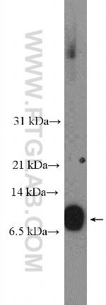 S100A16 Antibody in Western Blot (WB)