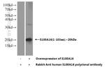 S100A16 Antibody in Western Blot (WB)