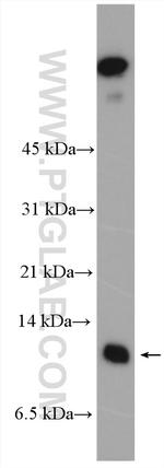 S100A16 Antibody in Western Blot (WB)