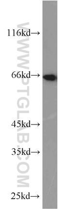 STXBP1 Antibody in Western Blot (WB)