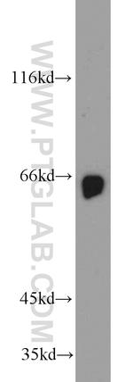 STXBP1 Antibody in Western Blot (WB)